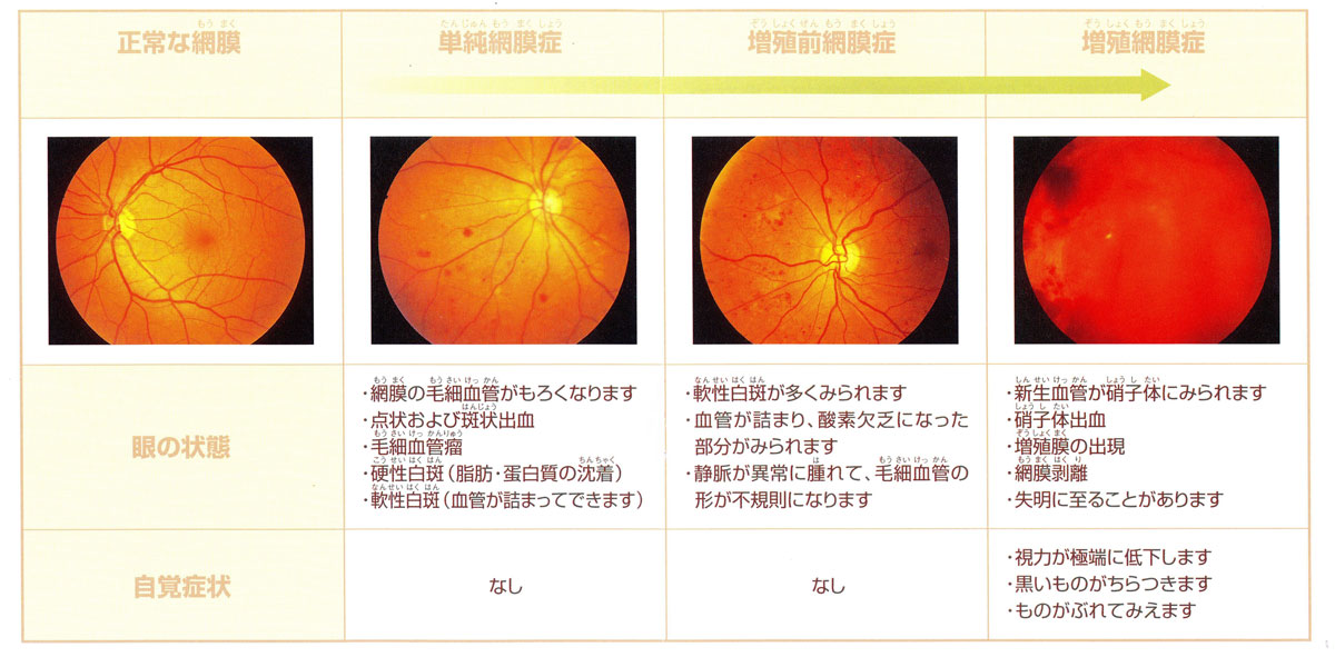 手順はどのように機能しますか?